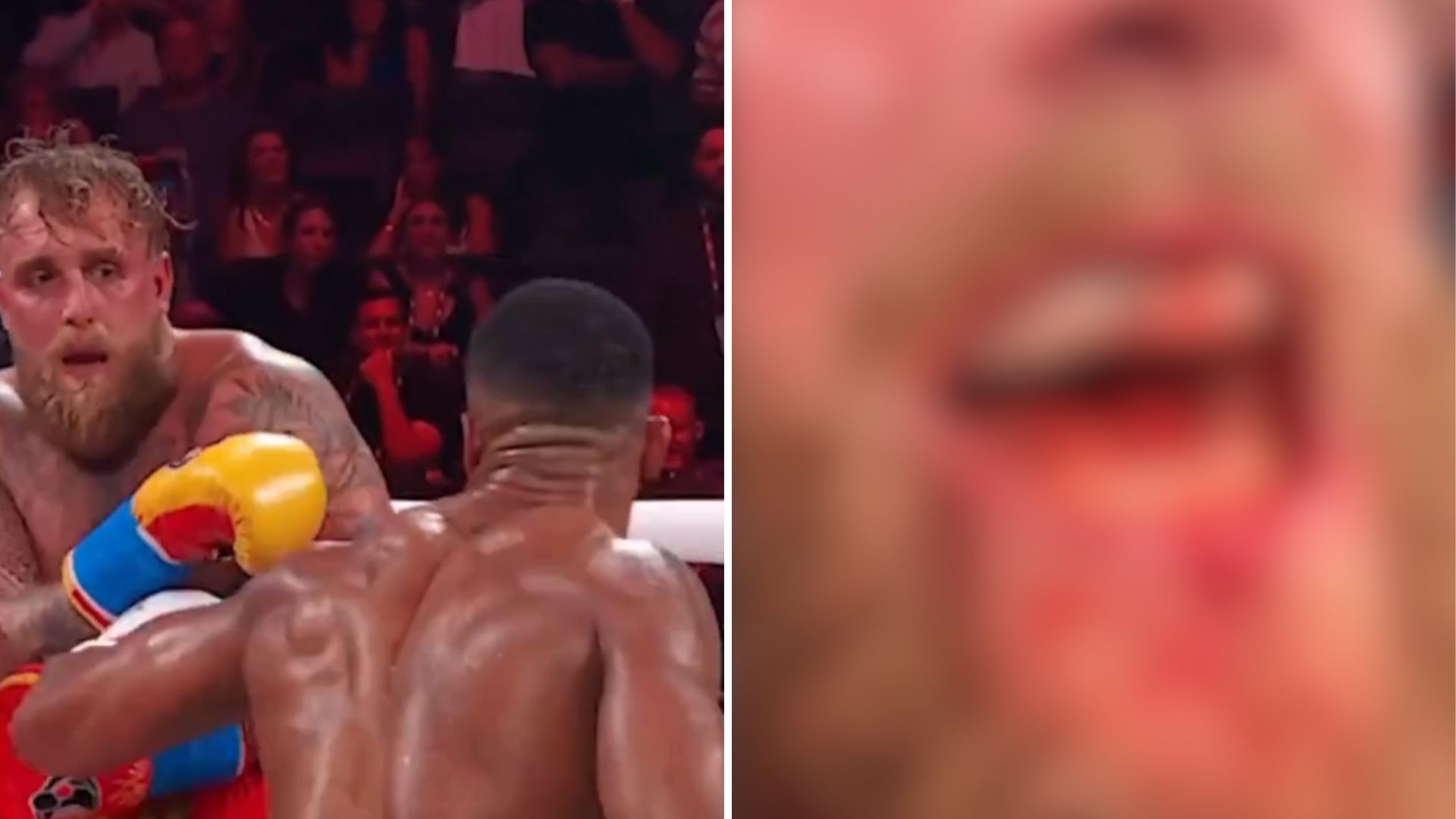 Jake Paul ze złamaną szczęką po nokaucie AJ-a. Youtuber pokazał obrażenia