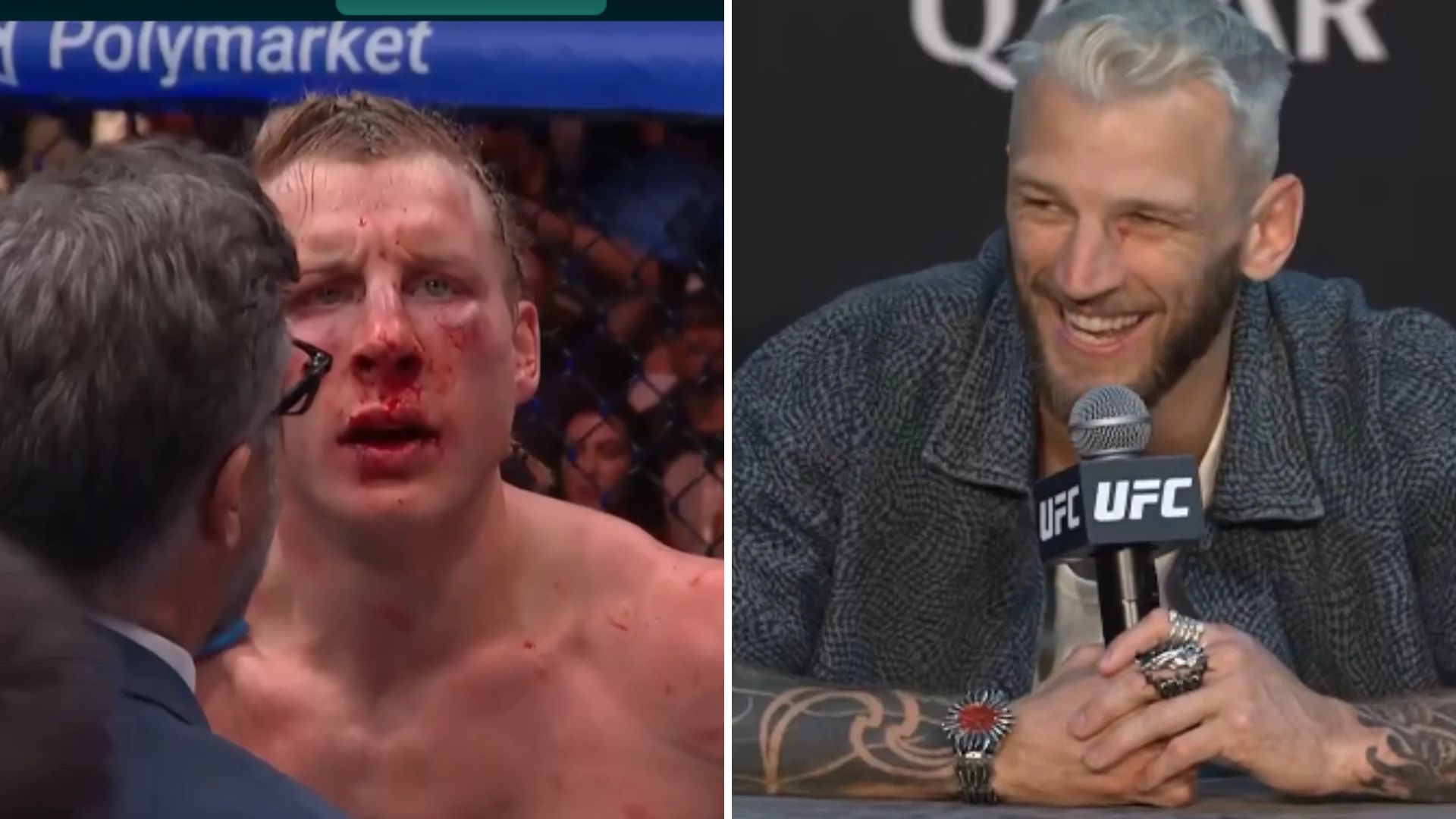 Dan Hooker beszta Paddy’ego Pimbletta: Widząc jego walki mam wrażenie, iż jest upośledzony